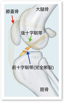 膝関節側面