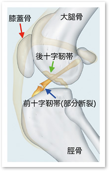 膝関節側面