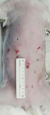 腹腔鏡下手術の傷