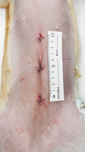 腹腔鏡手術の傷です