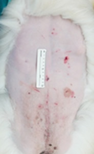 腹腔鏡下による肝生検の傷