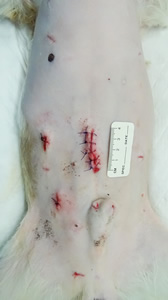 腹腔鏡下手術の傷